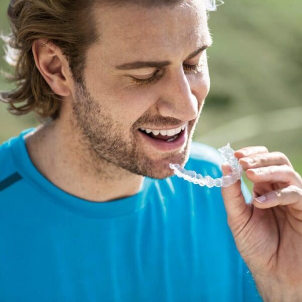 Life Smiles Better with Positeeth®: Real Patient Stories and Expert Insights on Achieving Stunning Results with Composite Bonding and Clear Aligners